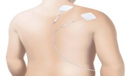 Stimulateur circulatoire Revitive Medic Pharma - Électrode sur l'épaule